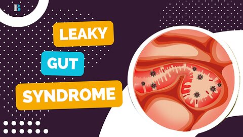 Unlocking the Secrets of Leaky Gut: Symptoms, Causes, and Natural Remedies