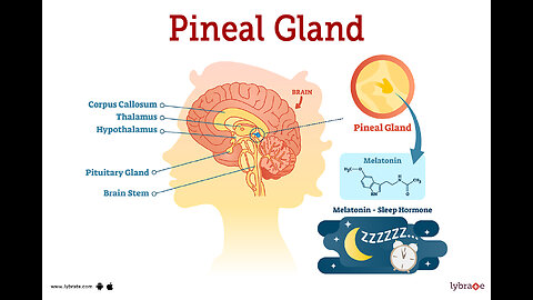pineal gland decalcification
