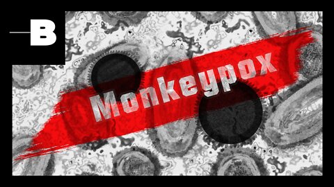 Monkeypox- cases and, how does the virus spread, and what are the symptoms? (UPGRADE)