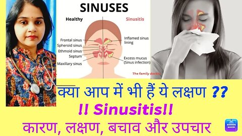 Sinusitis कारण लक्षण और होम्योपैथिक उपचार