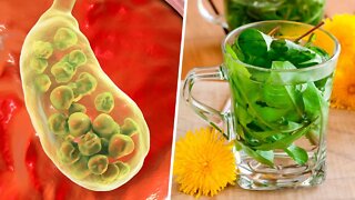 How to Get Rid of Gallstones Naturally (Gallbladder Cleanse)