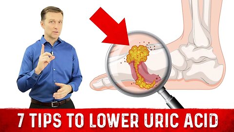 7 Tips to Lower Uric Acid – Dr. Berg