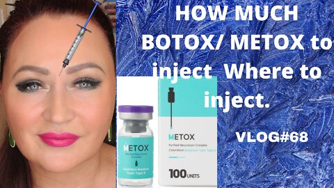 BOTOX with METOX UPPER FACE TREATMENT.., VLOG#68 #botox #metox #diybotox