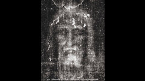 The Holy Face ~Chaplet
