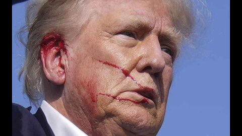 Seconds and Millimeter One Month After the Assassination Attempt on Donald Trump