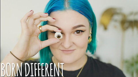 My Skin Caused Me To Lose An Eye | BORN DIFFERENT