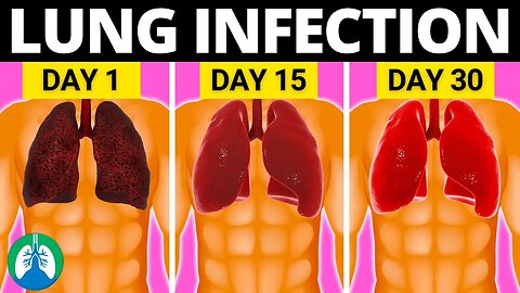 Top 10 Natural Lung Infection Treatments (Home Remedies)