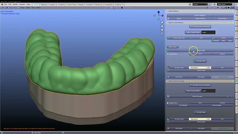 Increasing the thickness of a Layer/Splint