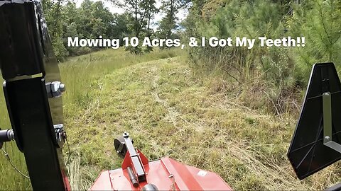 Mowing !0 Acres & Got My Teeth!