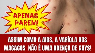 ASSIM COMO A AIDS, A VARÍOLA DOS MACACOS NÃO É UMA DOENÇA DE GAYS!