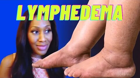 What Is Lymphedema and What Causes It? What Are the Best Treatments for Lymphedema?