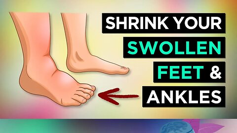 6 Ways To SHRINK Your SWOLLEN FEET & ANKLES (Remedies)