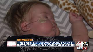 Youngest baby to get heart-lung transplant returns home to Kansas City