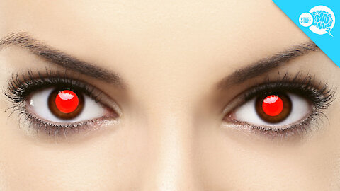 BrainStuff: What Causes Red Eye In Photos?