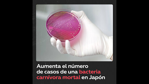 Bacteria capaz de matar a una persona en solo 2 días afecta a Japón