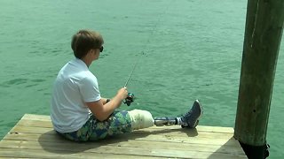 Fla. teen starts foundation to help kid amputees in need of specialized prosthetic