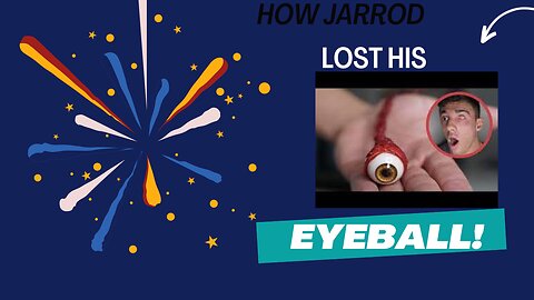 How Tiktok And Youtube Sensation Jarrod Stod Lost His Eyeball.