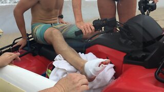 Firefighter off work after possible shark attack, strangers stepped in