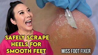 Safely Scrape Heels for Smooth Feet | By Famous Podiatrist Miss Foot Fixer