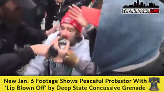 New Jan. 6 Footage Shows Peaceful Protestor With 'Lip Blown Off' by Deep State Concussive Grenade
