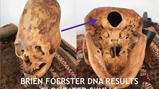 Elongated Skulls, DNA Results, Nephilim & Lost Ancient High Technology Artifact, Brien Foerster