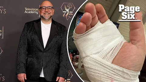 Food Network star Duff Goldman on 'long road to recovery' after allegedly being hit by drunk driver