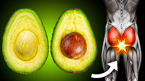 If you have any of these health problems, AVOID AVOCADO