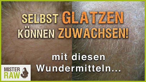 Auch Glatzen können zuwachsen! Haarwachstum Wunder aus Afrika! Seife & Creme regenerieren Hautflora