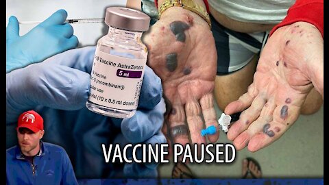 Vaccine PAUSED After Thousands of Extreme Adverse Reactions and Deaths