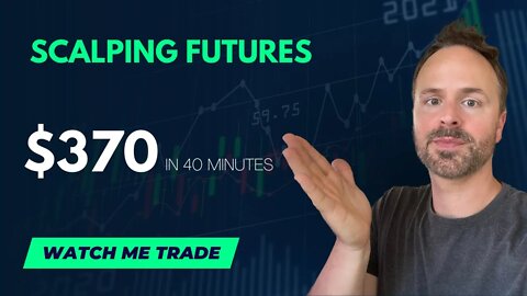 +$370 PROFIT | DAY TRADING | WATCH ME TRADE Nasdaq Futures Trading - Scalping Day Trading