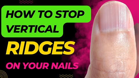 Do You Have Vertical Ridges On Your Nails? (Cause)