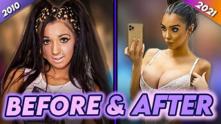 Chloe Khan | Before & After | How Plastic Surgery Ruined Her Health?
