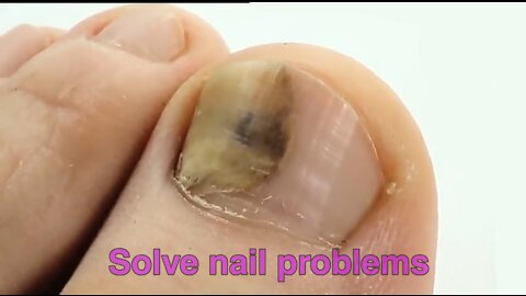The perfect solution to nail and hair problems that will surprise you