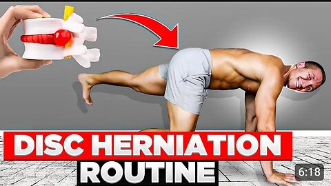 Effective Disc Herniation Exercise Routine: Relieve Pain and Restore Mobility