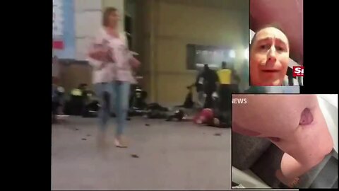 fake wounds crisis actors the Manchester Arena bombings