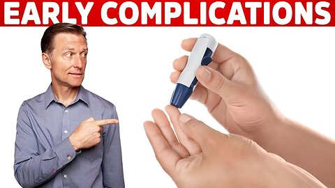 The First Complication of Diabetes – Dr. Berg on Prediabetes Symptoms