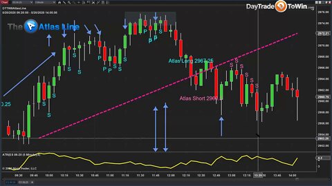 Pick Market Tops and Bottoms Like a Pro with Price Action Trading