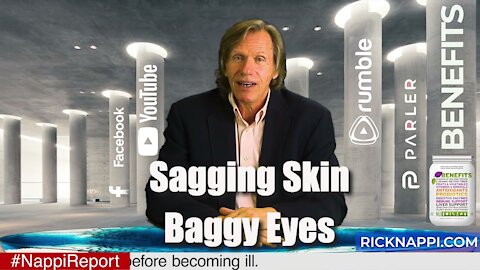 Sagging Skin with Rick Nappi #NappiReport