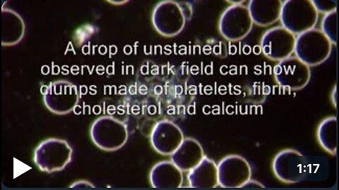 Dark Field Microscopy and Thrombosis