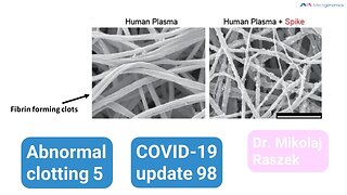 Spike protein role in abnormal clots 2 (abnormal clots episode 5 - update 98)