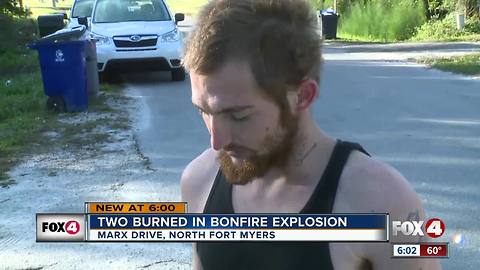 Two severely burned in bonfire accident in North Fort Myers