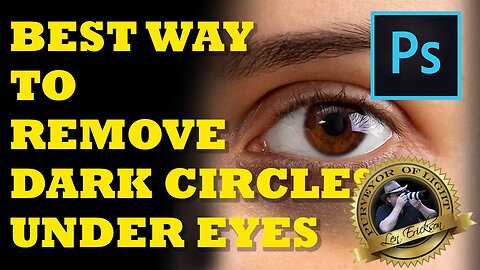 Best Way to Remove Dark Circles under Eyes in Photoshop