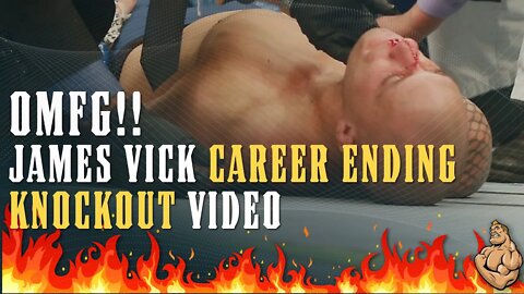 OMFG!!! INSANE Video of James Vick Career Ending Jaw Breaking KNOCKOUT