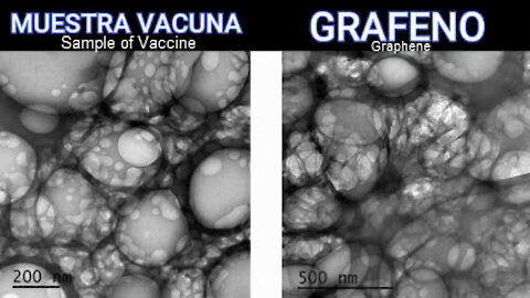 WtF's Evening Tyranny Report 07-06-2021 Graphene Oxide Injections?