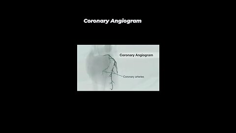 "Clearing the Path to Heart Health: Exploring Coronary Angiograms and their Vital Role in Diagnosis"