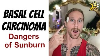 Basal Cell Carcinoma & The Dangers of Sunburn