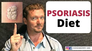 The Psoriasis Diet. Better than Medicine?? 2021