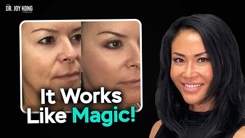 Transform Your Looks WITHOUT Surgery (The Power of the Fotona 4D Laser) | Dr. Joy Kong & Jenny Jones