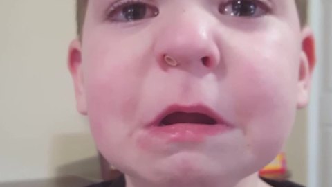 Funny Boy Gets A Lego Head Stuck Up His Nose