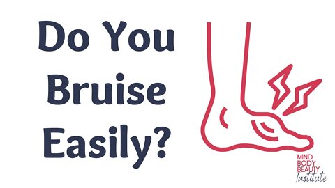 Do You Bruise Easily?